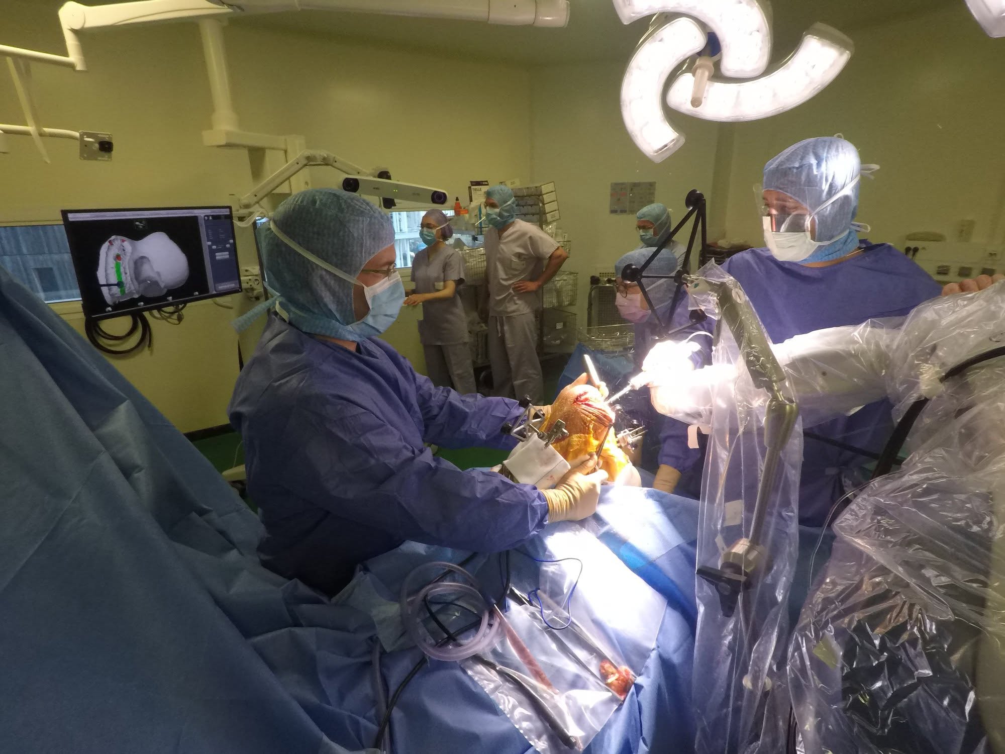 Première prothèse partielle de genou assistée par robot MAKO® en France — 3 septembre 2018, Clinique Tivoli Bordeaux
