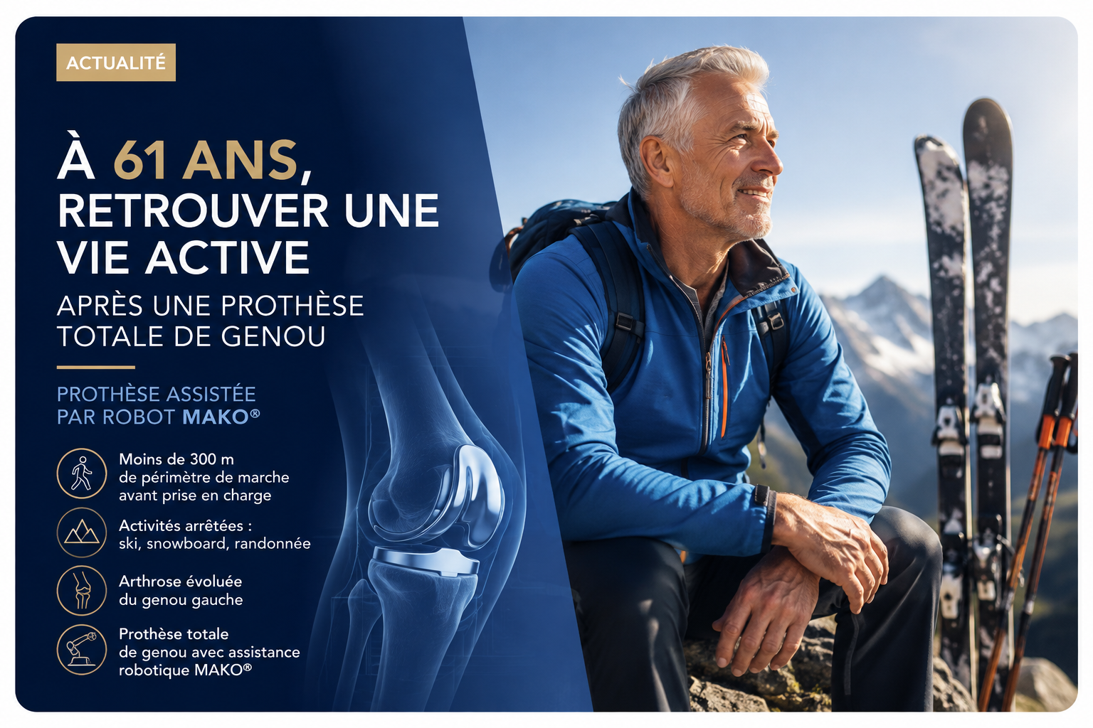 Patient de 61 ans — vie active après prothèse totale de genou assistée par robot MAKO® à Bordeaux