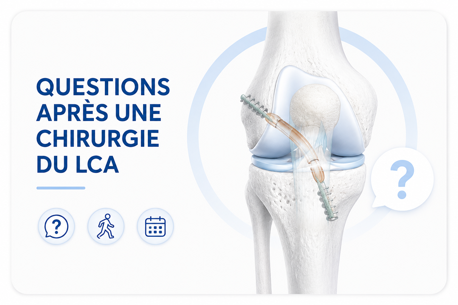 Questions après une chirurgie du ligament croisé