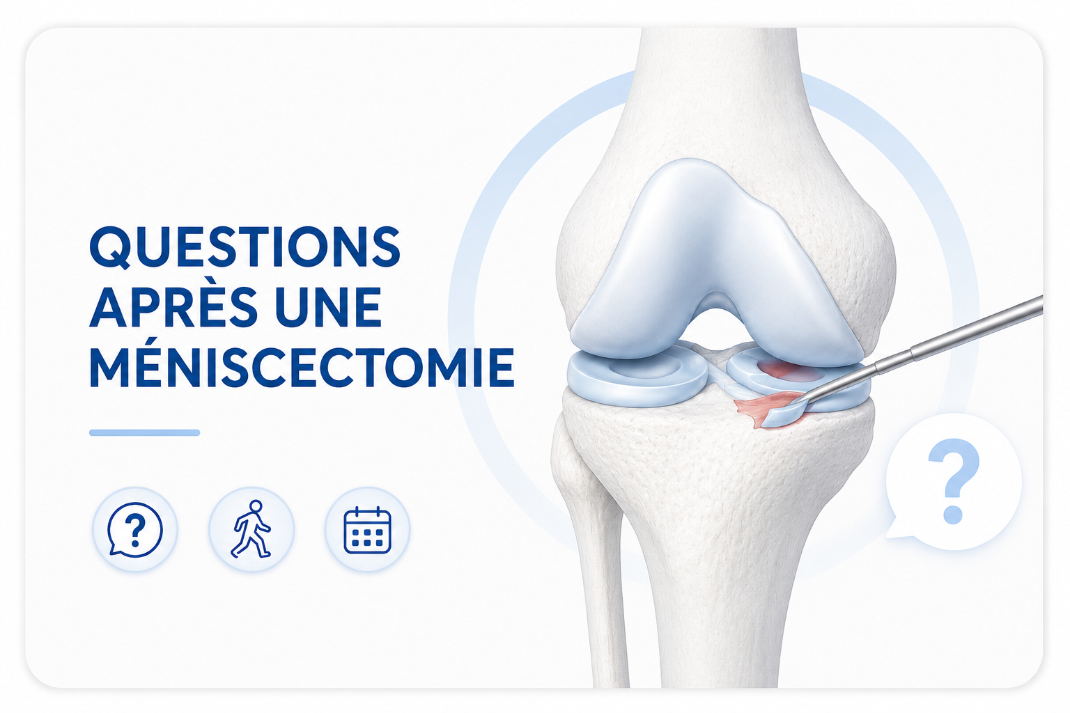 Questions après une chirurgie de méniscectomie
